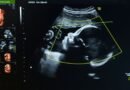 Los ‘químicos eternos’ afectan el sistema inmune de mujeres embarazadas y sus fetos