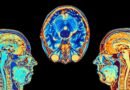 Después de todo, el cerebro del optimista sí se comporta distinto al del pesimista