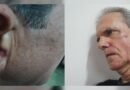 «Me dio con todo»: teniente coronel del régimen golpea a escritor cubano