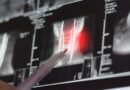 Científicos desarrollan una inyección para reducir tumores cancerígenos de cabeza y cuello en semanas